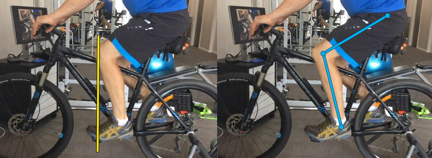 Bike Fit Assessment Sapphire Coast Physio